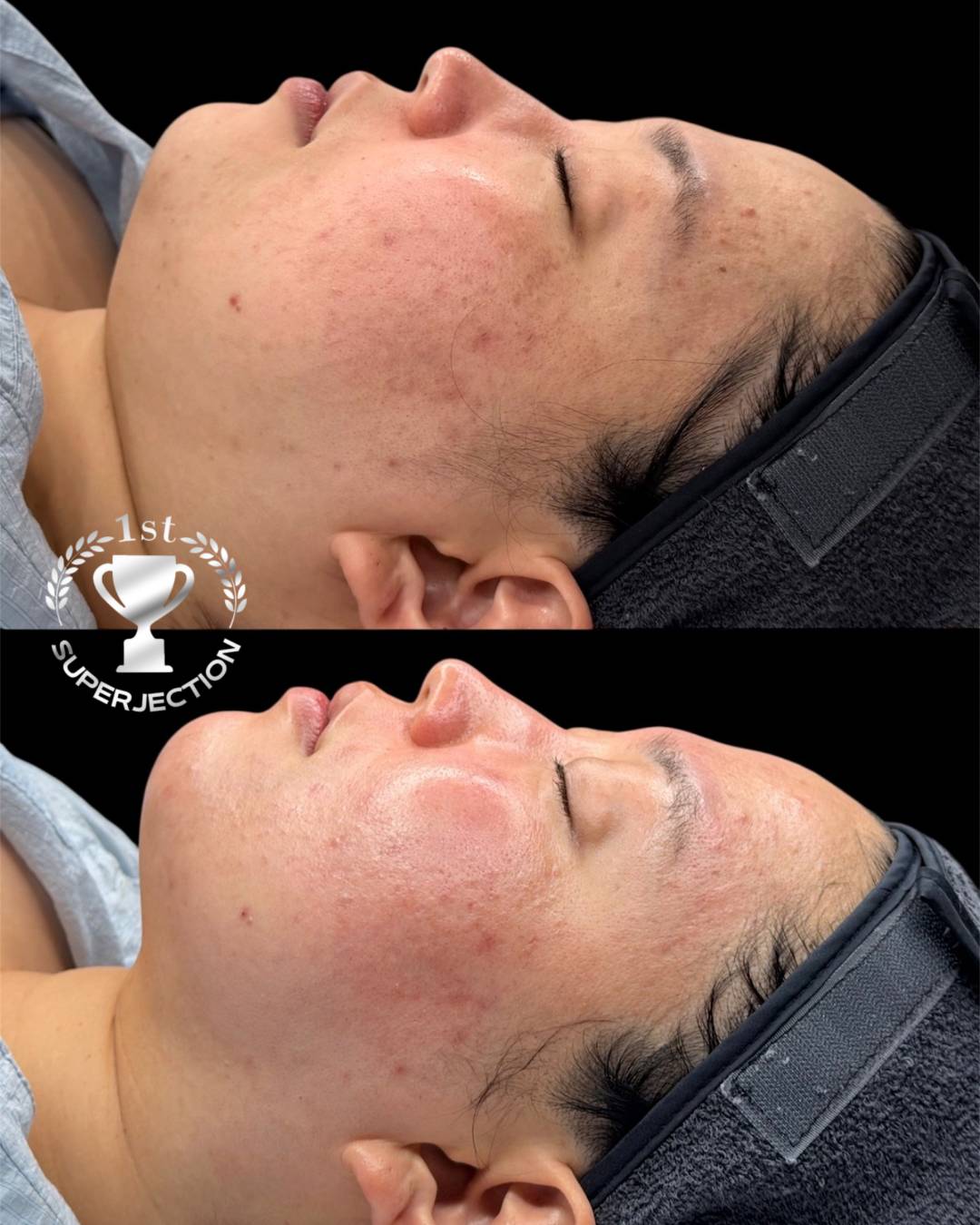 에그뮤즈 스킨스칼프 동탄점 대표 이미지