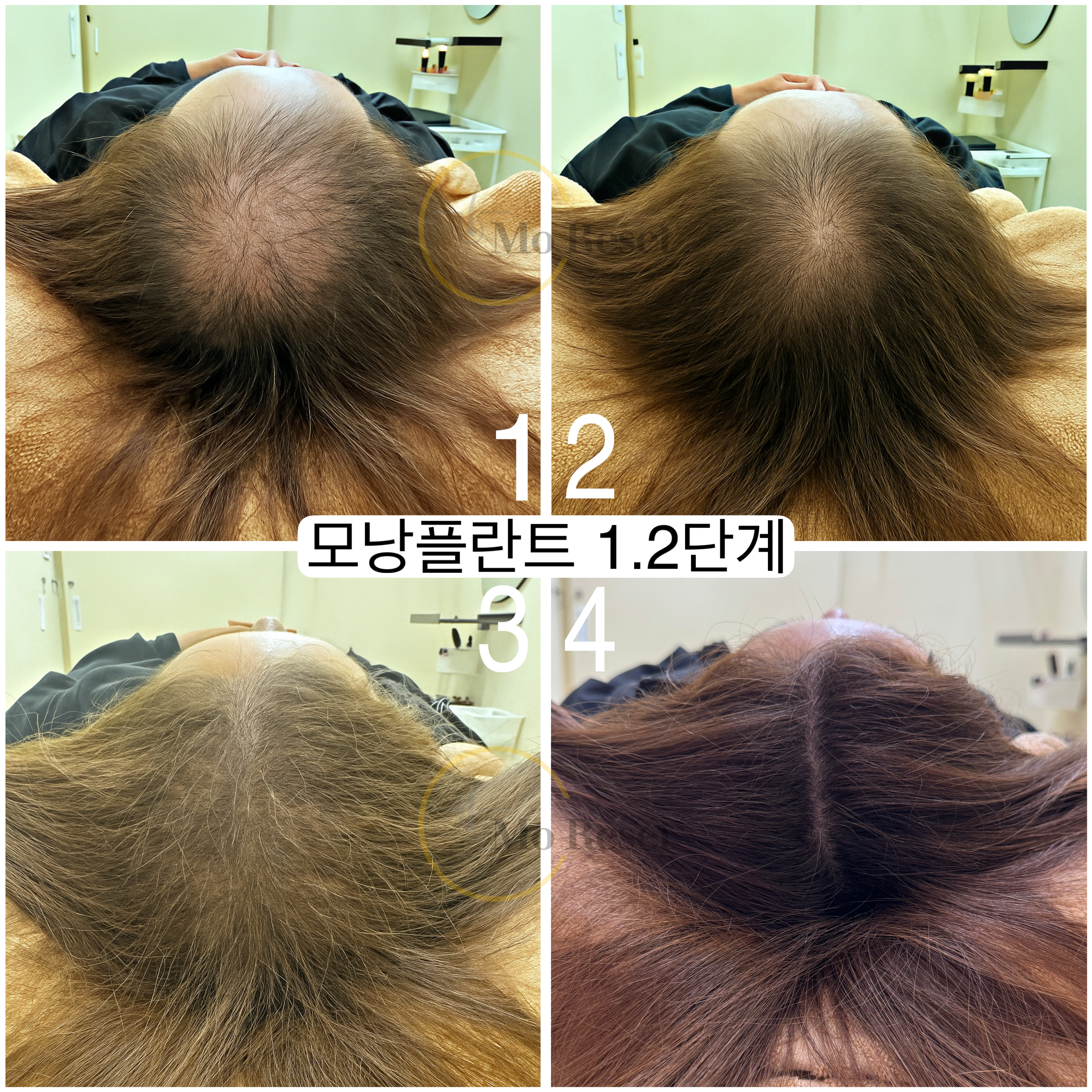 모리셋두피재생센터 창원점 대표 이미지