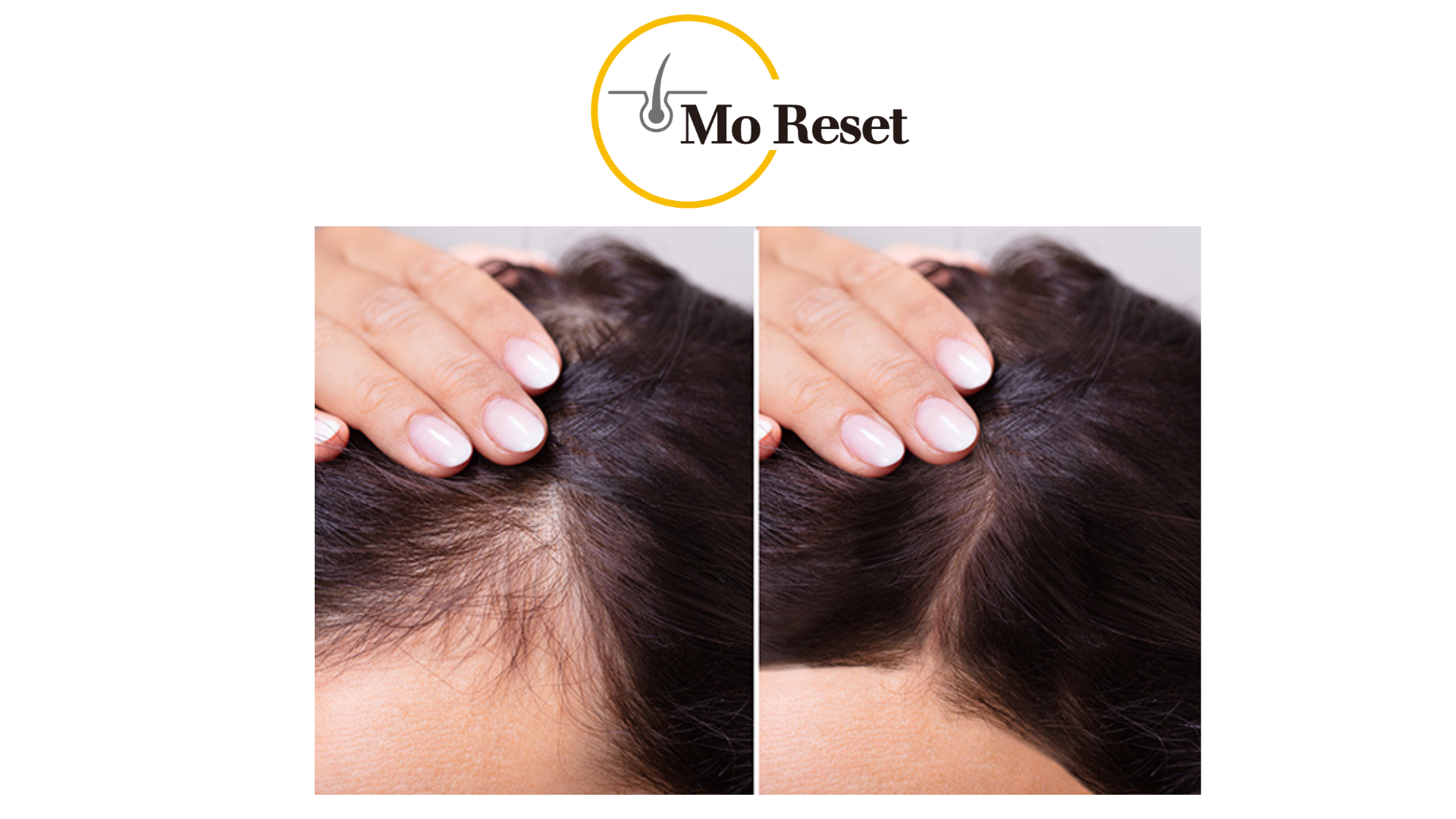 모리셋두피재생센터 창원점 대표 이미지