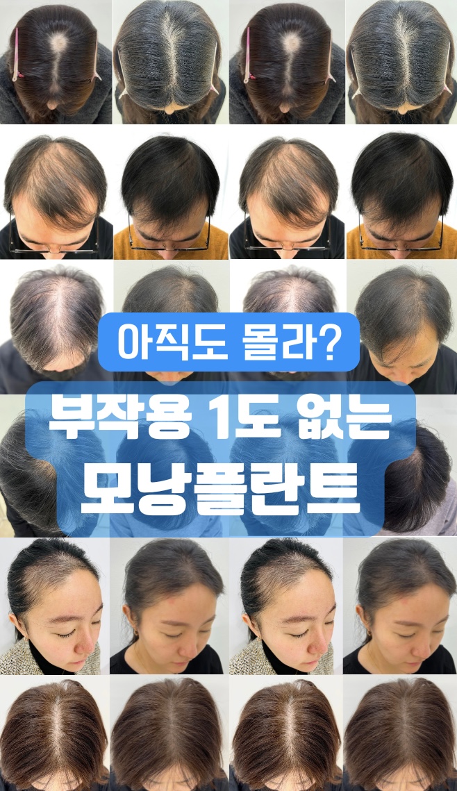 모리셋두피재생센터 대표 이미지