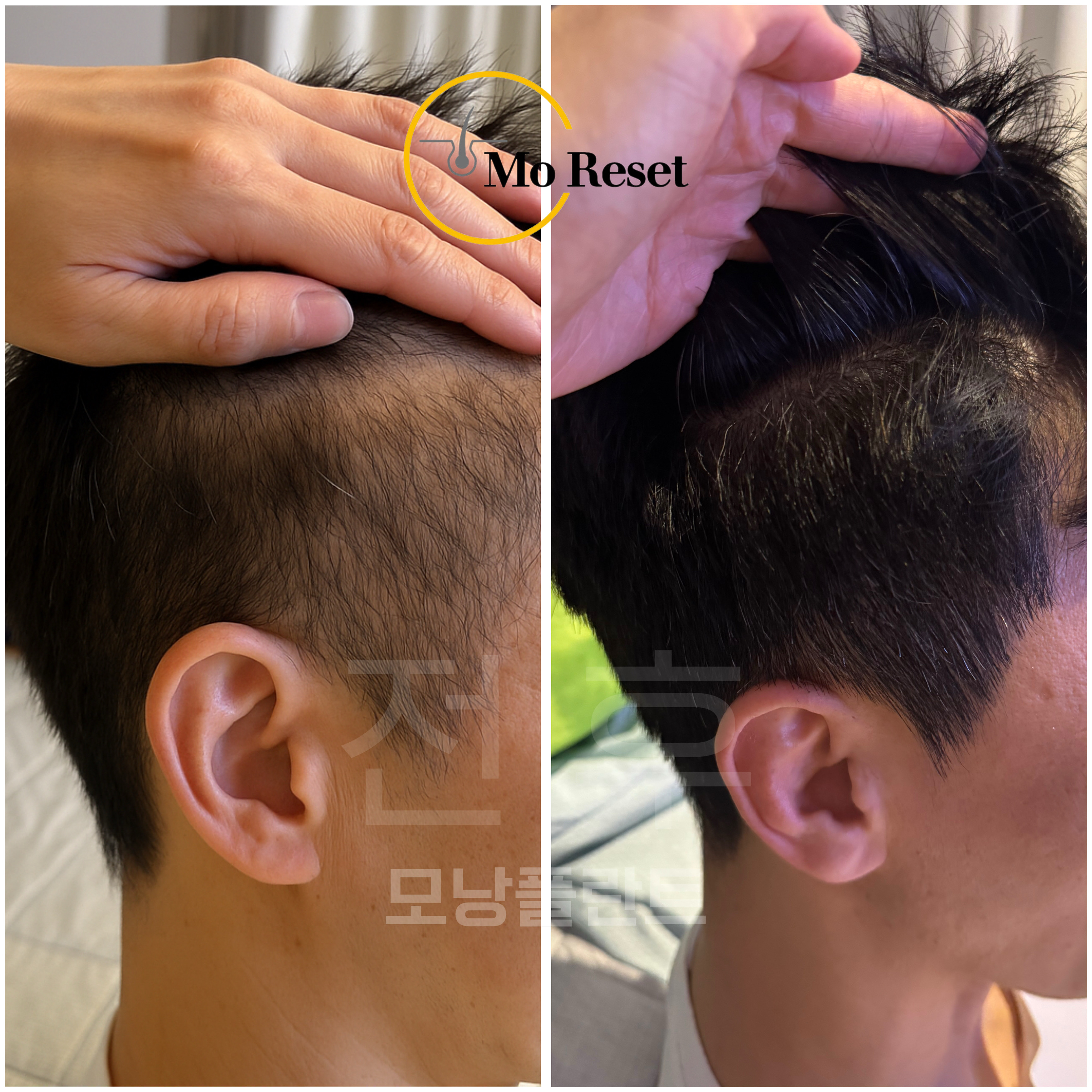 모리셋두피재생센터 창원점 대표 이미지