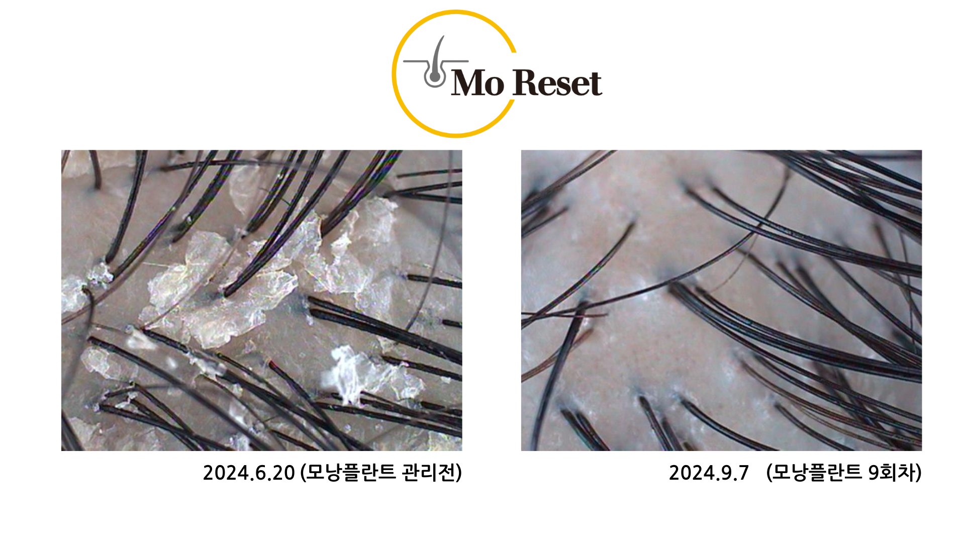 모리셋두피재생센터 창원점 대표 이미지