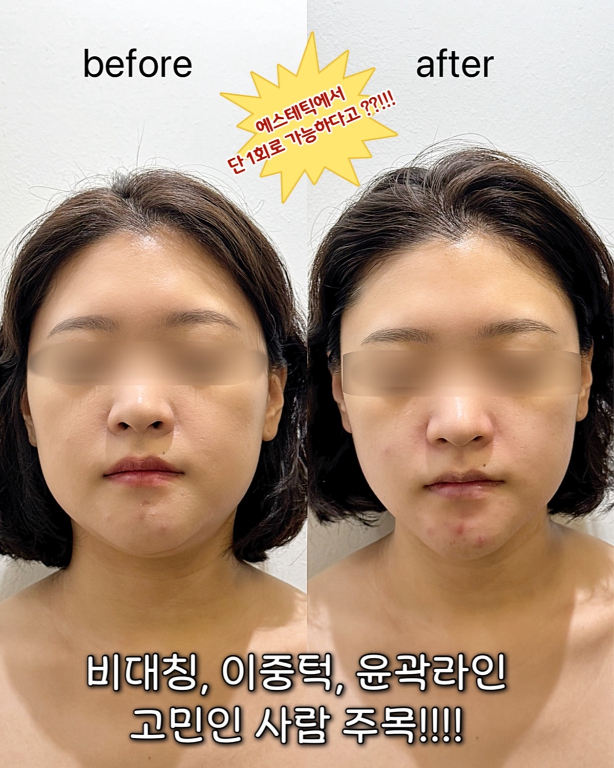 에스떼리 photo 3