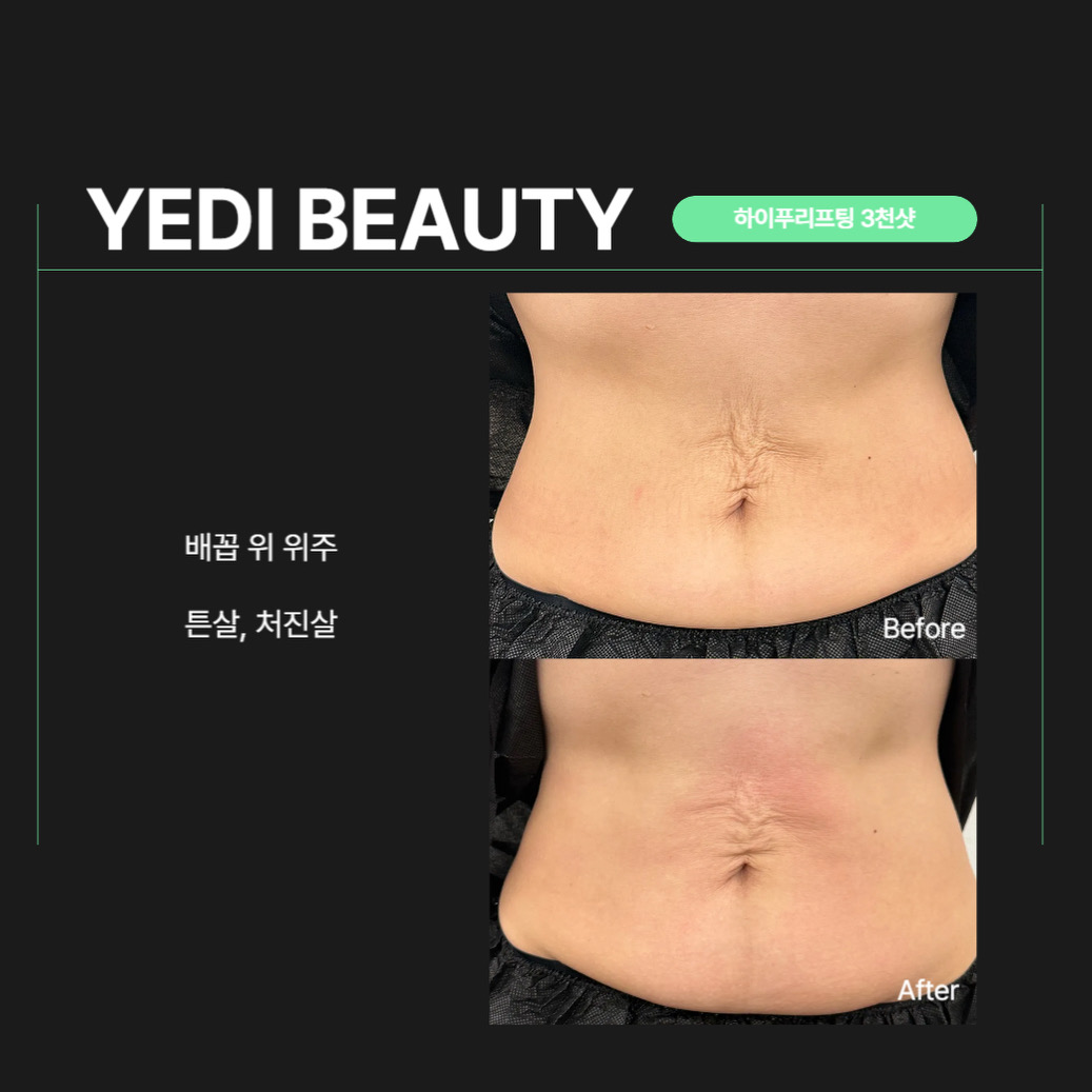 예디뷰티 대표 이미지
