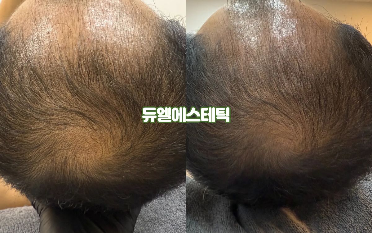 듀엘에스테틱 대표 이미지