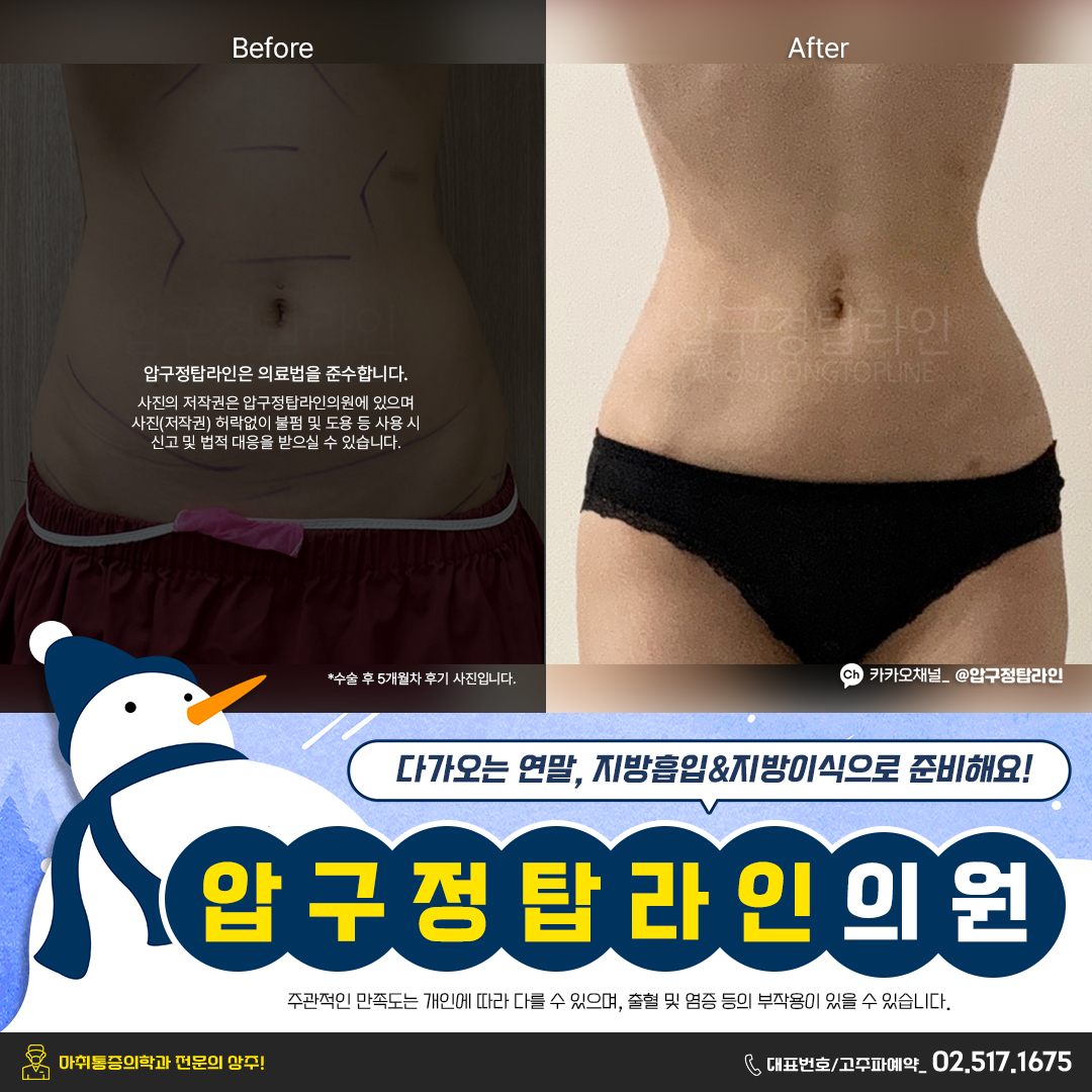 압구정탑라인의원 대표 이미지
