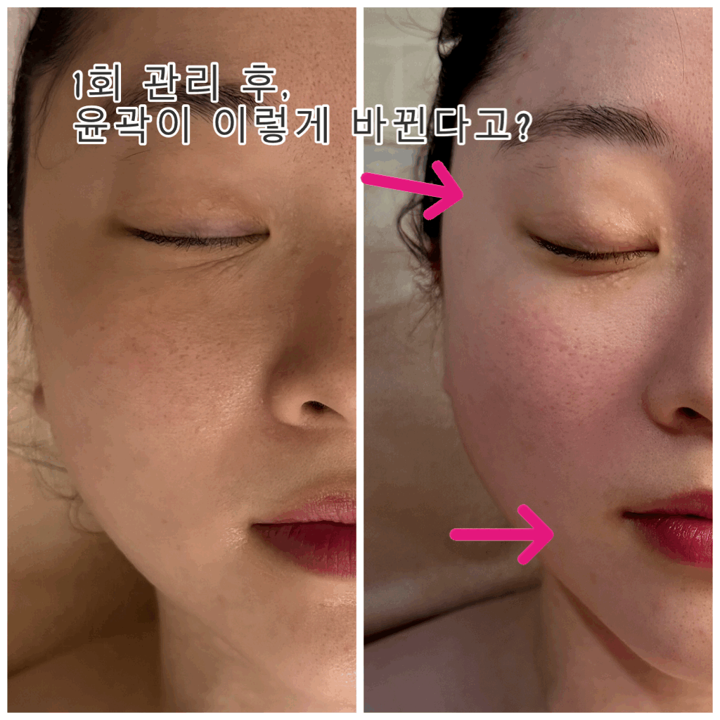 온하다에스테틱 첨단점 photo 4