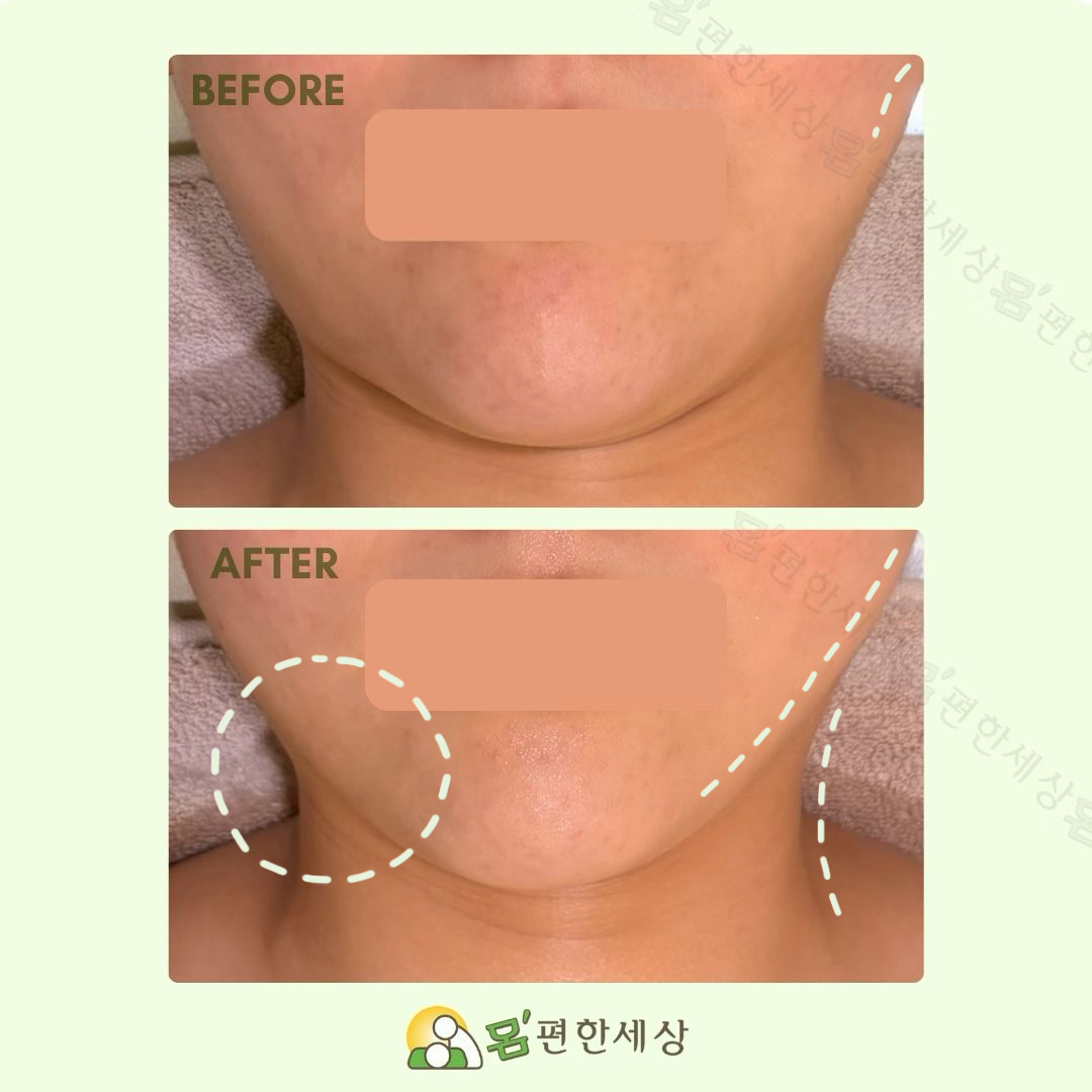 몸편한세상 photo 3