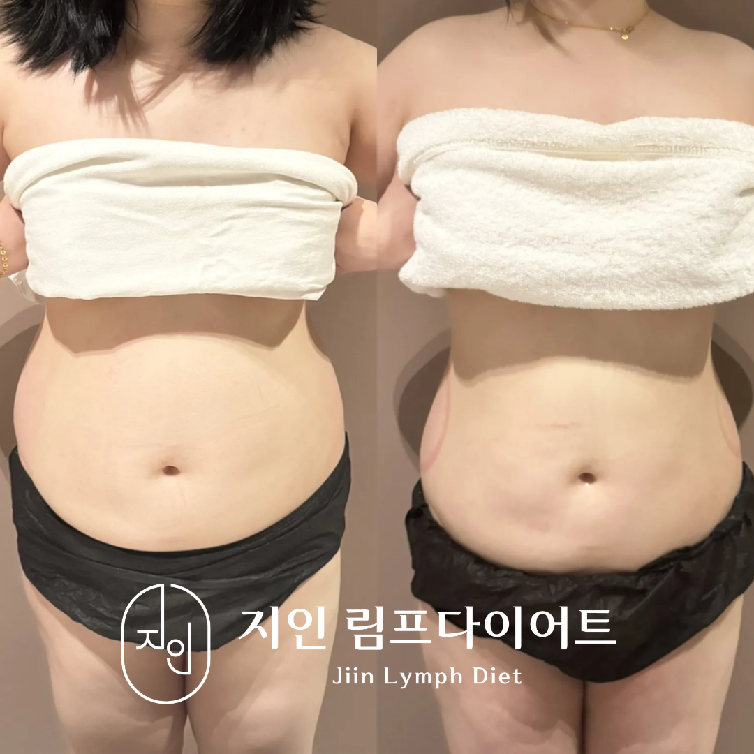 지인림프다이어트 photo 4