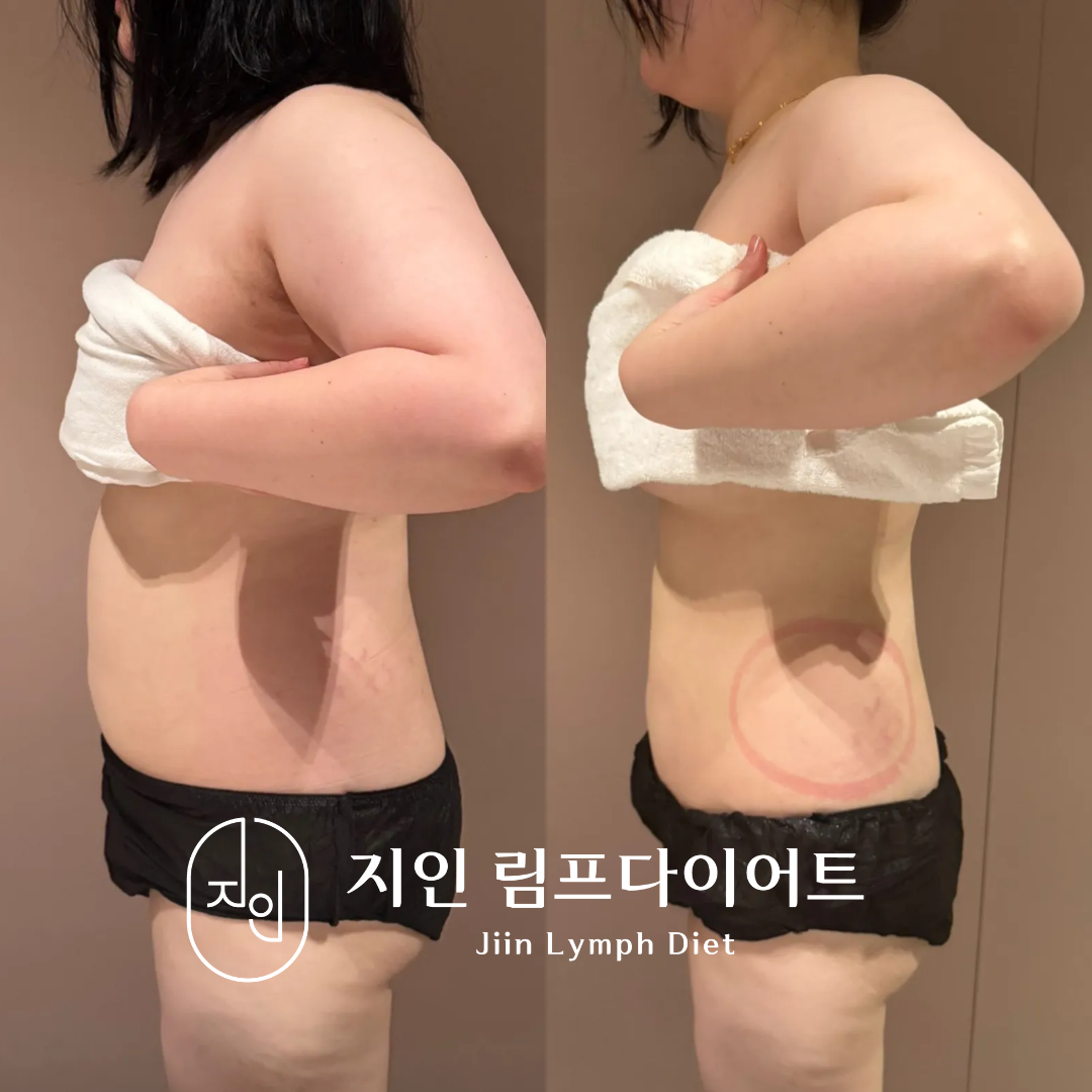 지인림프다이어트 photo 2