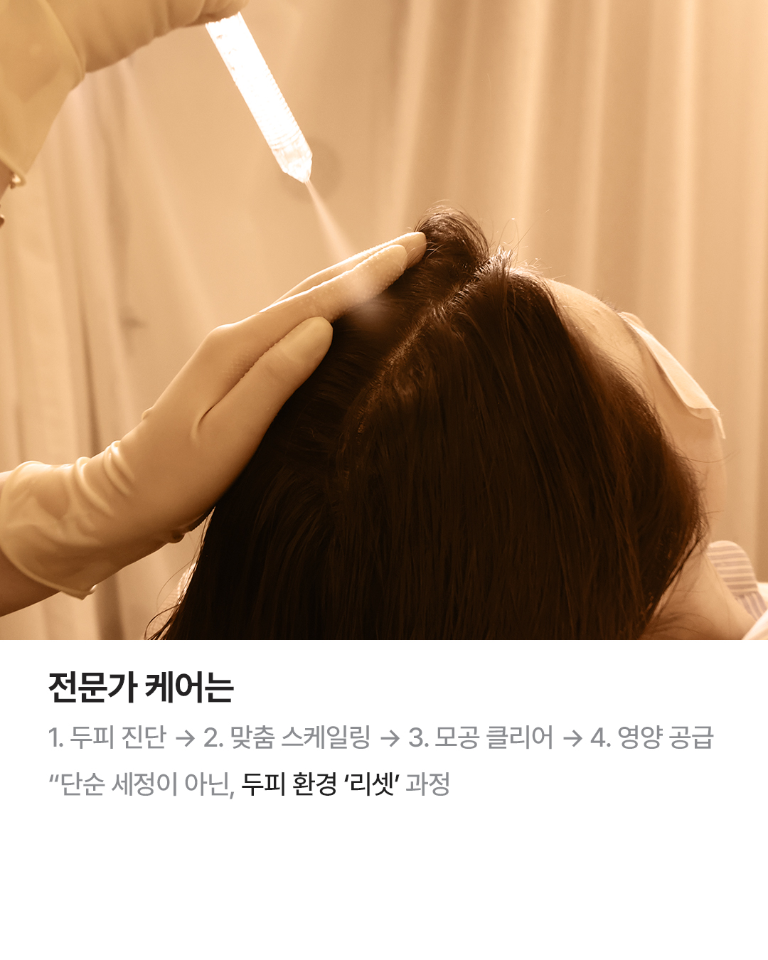 웰킨 두피탈모센터 종로점