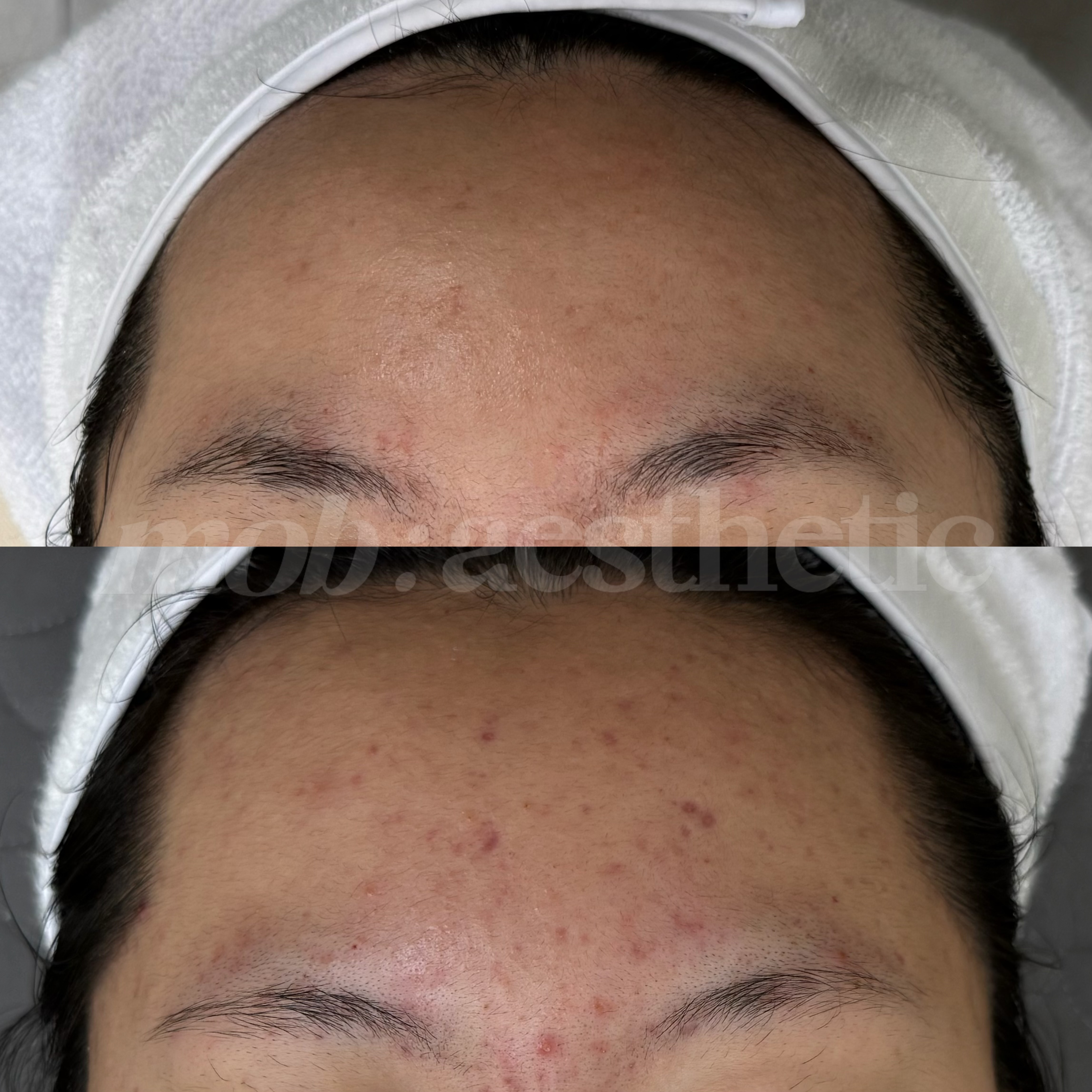 모브스킨 대표 이미지