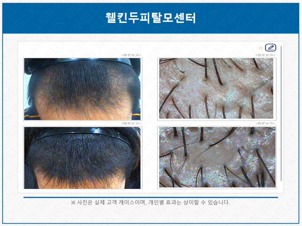 웰킨두피탈모센터 마곡점 대표 이미지