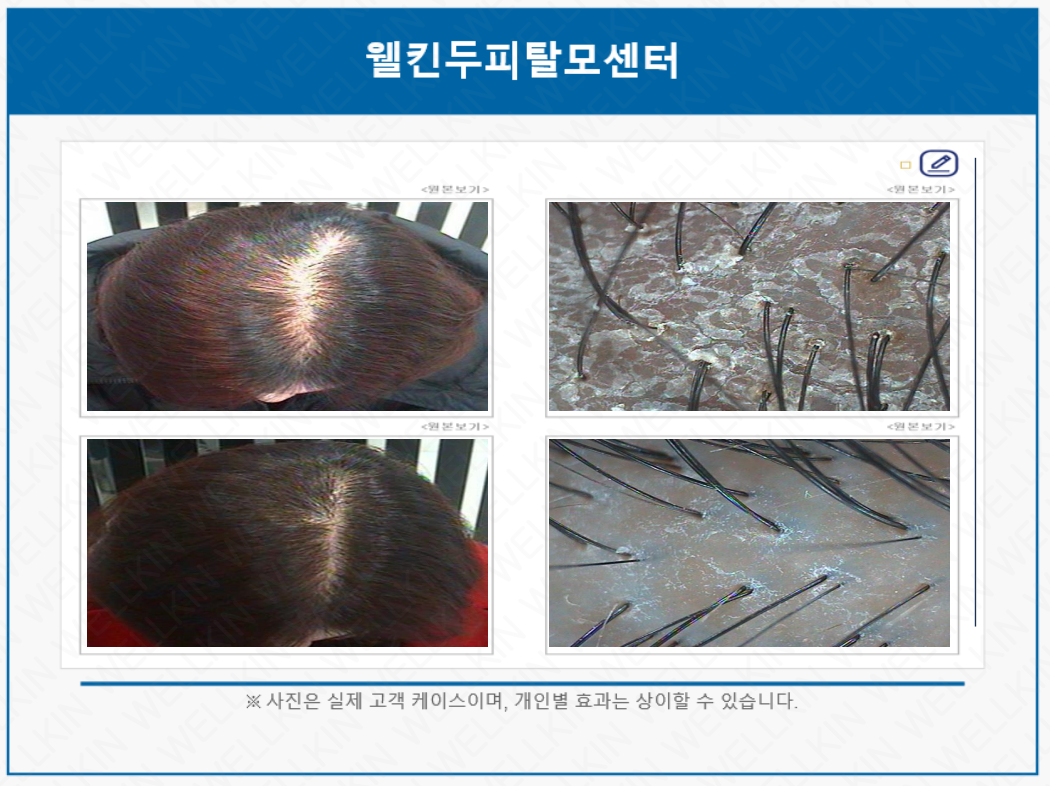 웰킨두피탈모센터 마곡점 대표 이미지