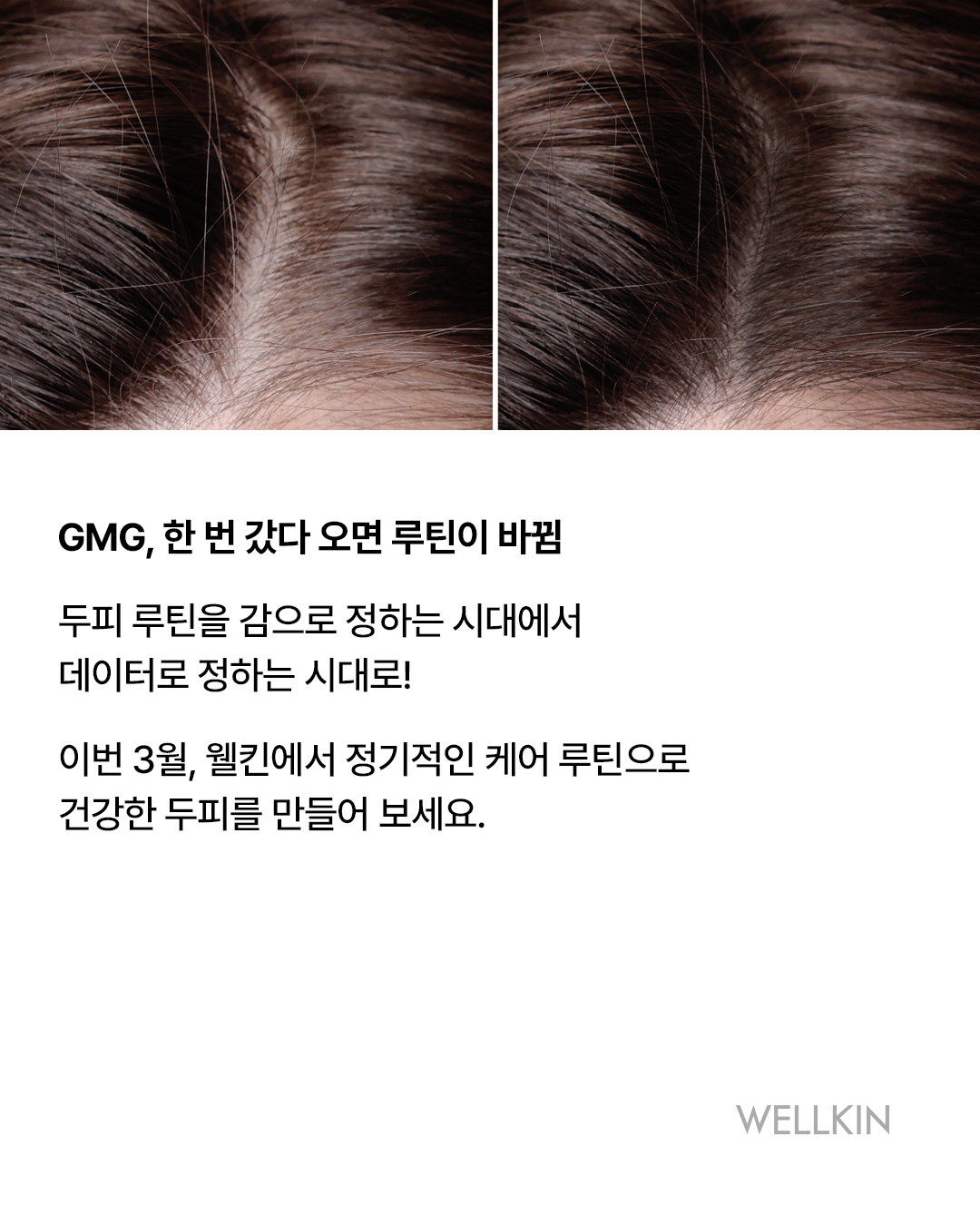 웰킨 두피탈모센터 종로점 이미지