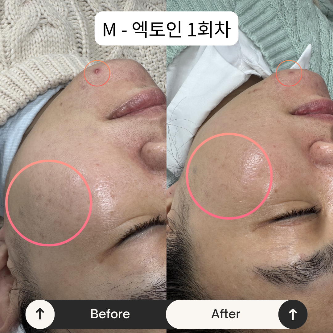 오늘도 새로운 하루 photo 8