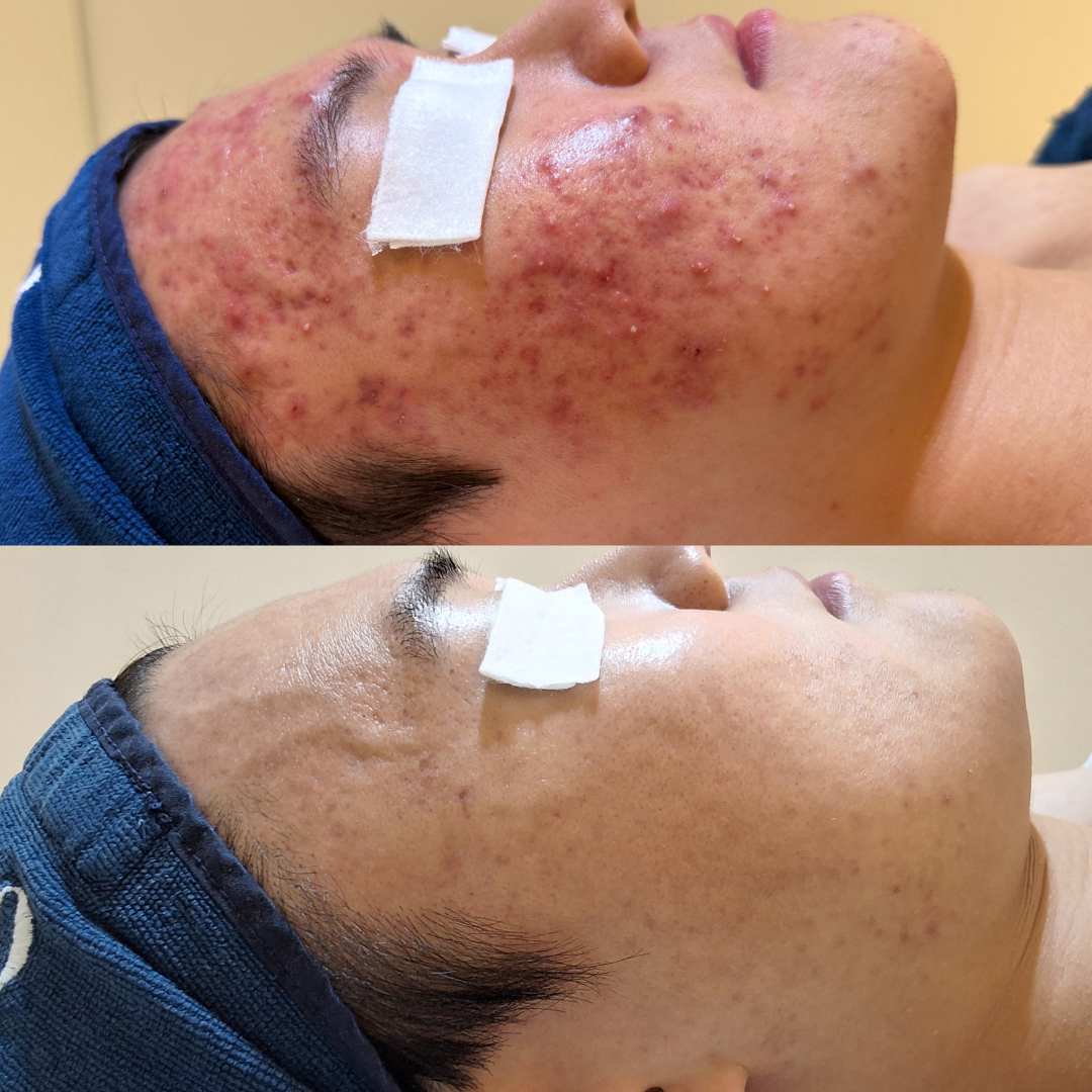 오하에스테틱 대표 이미지