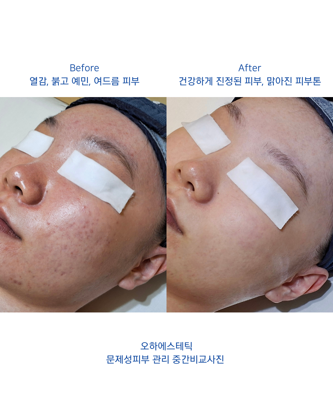 오하에스테틱 대표 이미지
