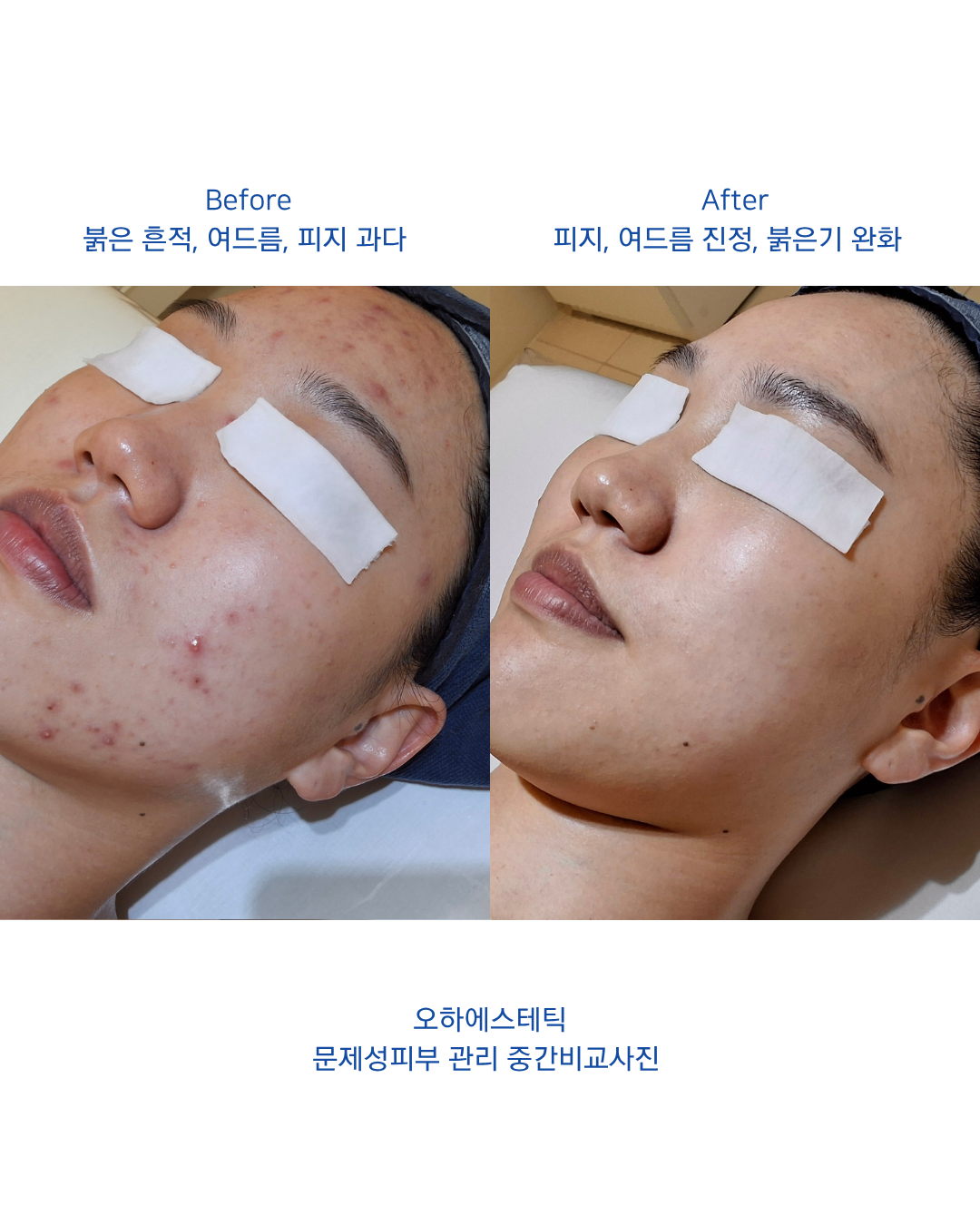 오하에스테틱 대표 이미지