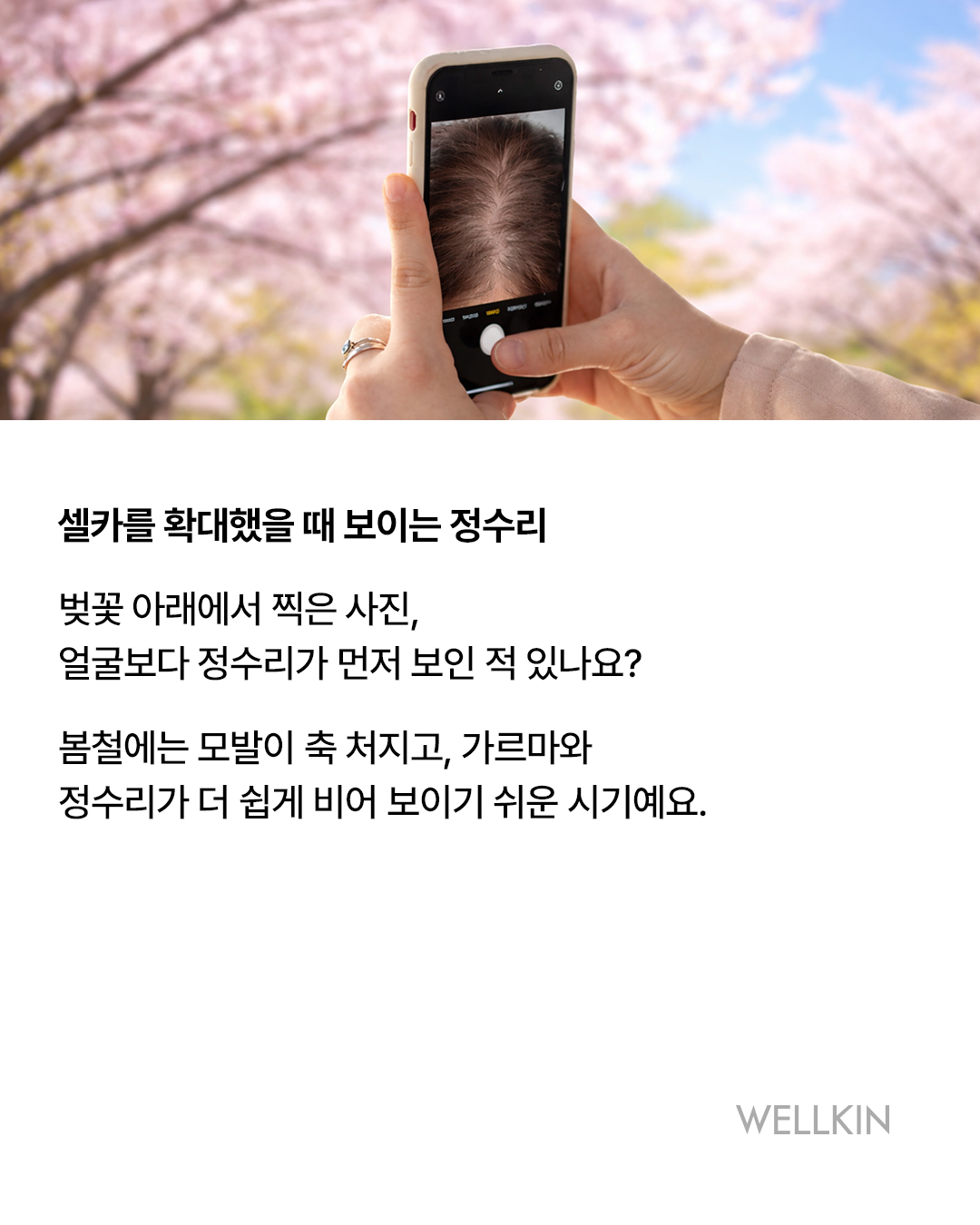 웰킨 두피탈모센터 종로점 대표 이미지