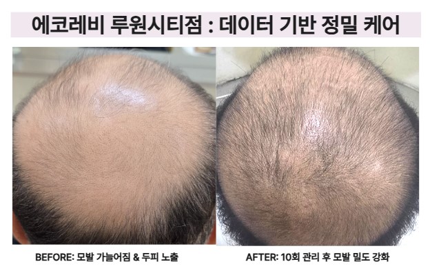 에코
